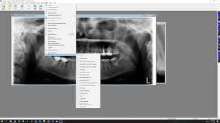 Training Video - XrayVision 4: Creating Document Templates