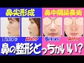 【鼻整形】顔の印象がガラッと変わる鼻の整形！鼻中隔延長術と鼻尖形成どっちが効果的？