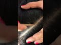 #fypviralシ #statisfying #lice #hair #LiceOnHead #liceremoval  #brasil #xyzbcafyp #licecomb  #kutu