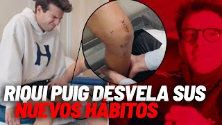 Las Cicatrices De Riqui Puig Y La Enfermedad De La Luz Roja De Marcos Llorente