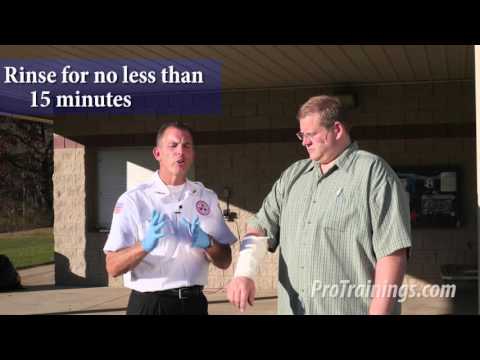 Video: First Aid For Burns - Thermal, Chemical