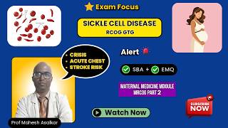 Sickle Cell Disease in Pregnancy | MRCOG Part 2 & Part 3 | Crisis, ACS, Stroke & Labour Management