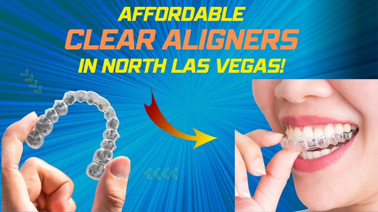 Affordable clear aligners in North Las Vegas (702) 329-3230 NLV ...
