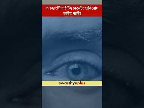 কনজাংটিভাইটিছ কেনেকৈ প্ৰতিৰোধ কৰিব পাৰি? | Prevention of Conjunctivitis | Dr Emee Gogoi | #Shorts