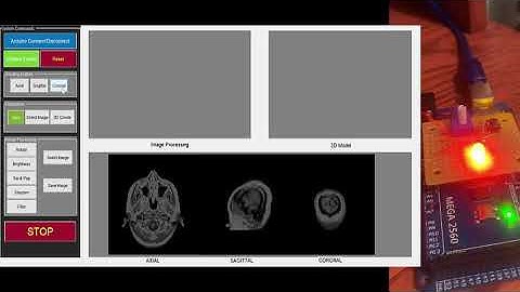 3D Segmentation and MATLAB Slicer