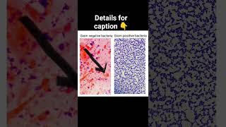 Gram Or Gram - Bacteria Under The Microscope .