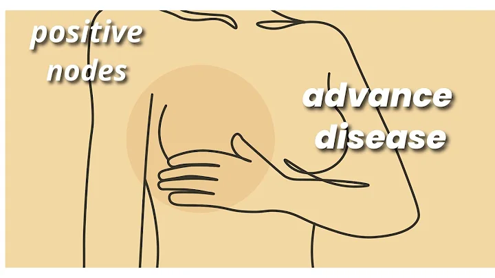 Easy Way to Memorize Breast Cancer Staging (NCCN) | Effortless Staging Guide for Everyone