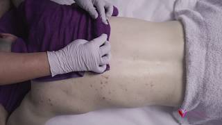 Silky Skin Back Facial