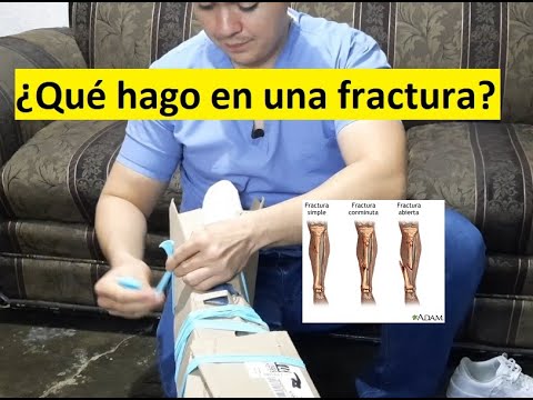 Video: Cómo comprobar si hay una fractura al realizar primeros auxilios: 14 pasos