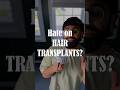 I WANT a HAIR TRANSPLANT #thinninghair #balding #hairtransplant #menshair