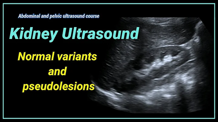 Kidney ultrasound  2- Normal variants and pseudolesions - DayDayNews