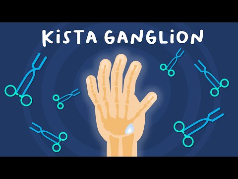 Video: Bagaimana ganglion terbentuk?