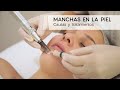 Manchas en la piel - Causas y tratamientos