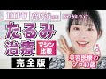 【たるみ治療マシン比較・完全版】HIFUや高周波、どれを選ぶ?年間100回美容医療をやる40歳が徹底解説