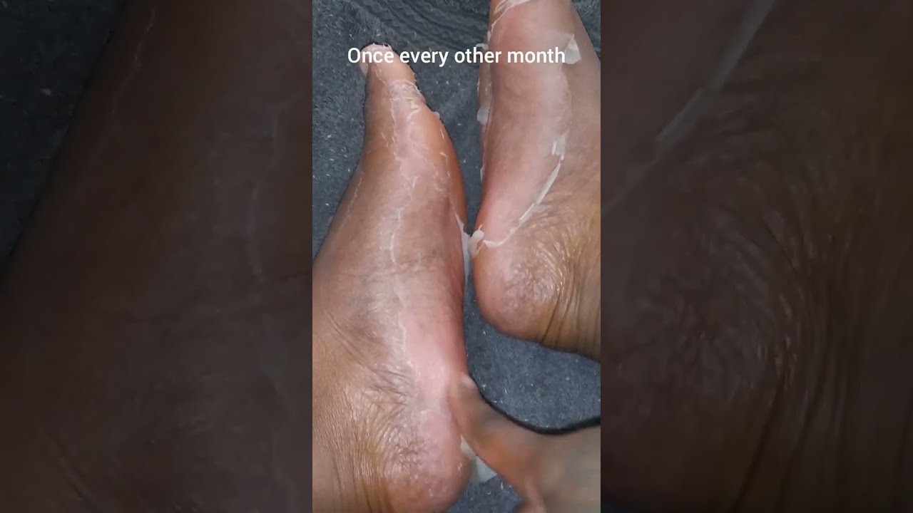 🎀 🦶Dr. Scholl's Foot Peeling Mask🦶🎀  #readdescription 