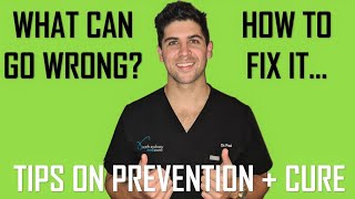 Wisdom Tooth Removal (Extraction) - Potential Problems + How to Fix Them | Dr Paul Shalhoub by Dr Paul's Dental World 2,763 views 3 years ago 10 minutes, 40 seconds