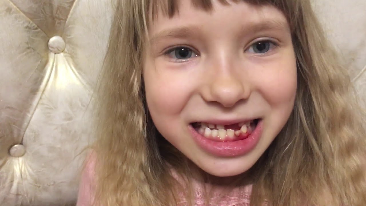 Мастер-класс как вырвать молочный зуб - YouTube