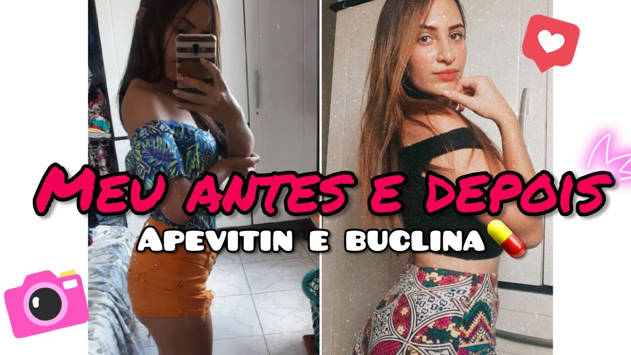APEVITIN BC E BUCLINA💊 #2 Engordei 5kg em menos de 4 semanas 💊 ...
