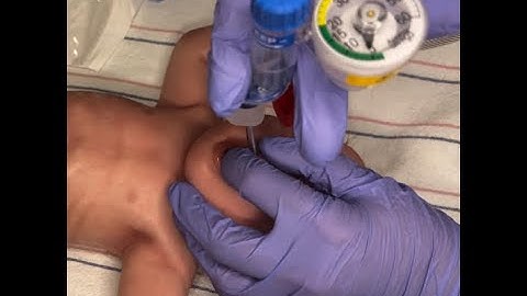 Use of the Neo-Tee T-Piece Resuscitator@McGlinnInstituteNeonatal