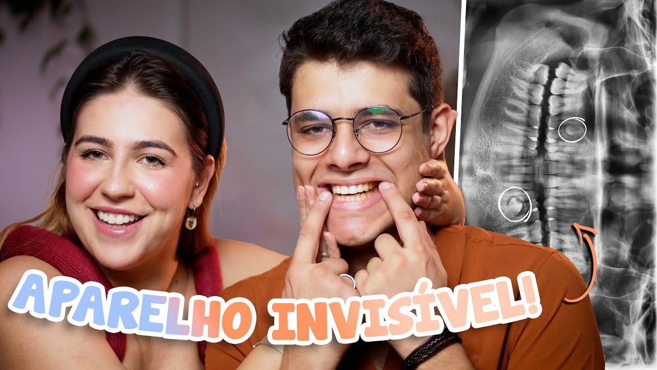 Tratamento Com Aparelho da SouSmile: É bom? Preços? Quanto tempo? | Tabatha Cuzziol