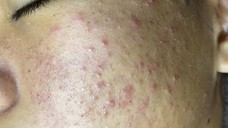 Satisfying and Relaxation with SURI NGUYEN Beauty Spa Video #463