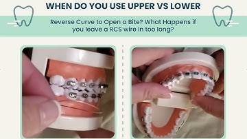 Reverse Curve Wire Dangers/ Upper vs Lower RCS Wires/ ACS Wires