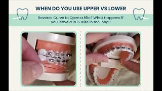 Reverse Curve Wire Dangers/ Upper vs Lower RCS Wires/ ACS Wires