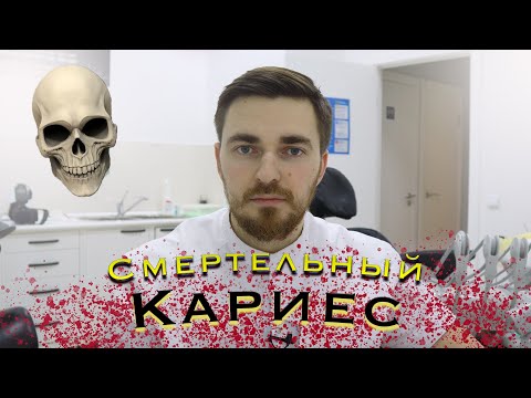 Смертельный кариес! Можно ли умереть от кариеса?