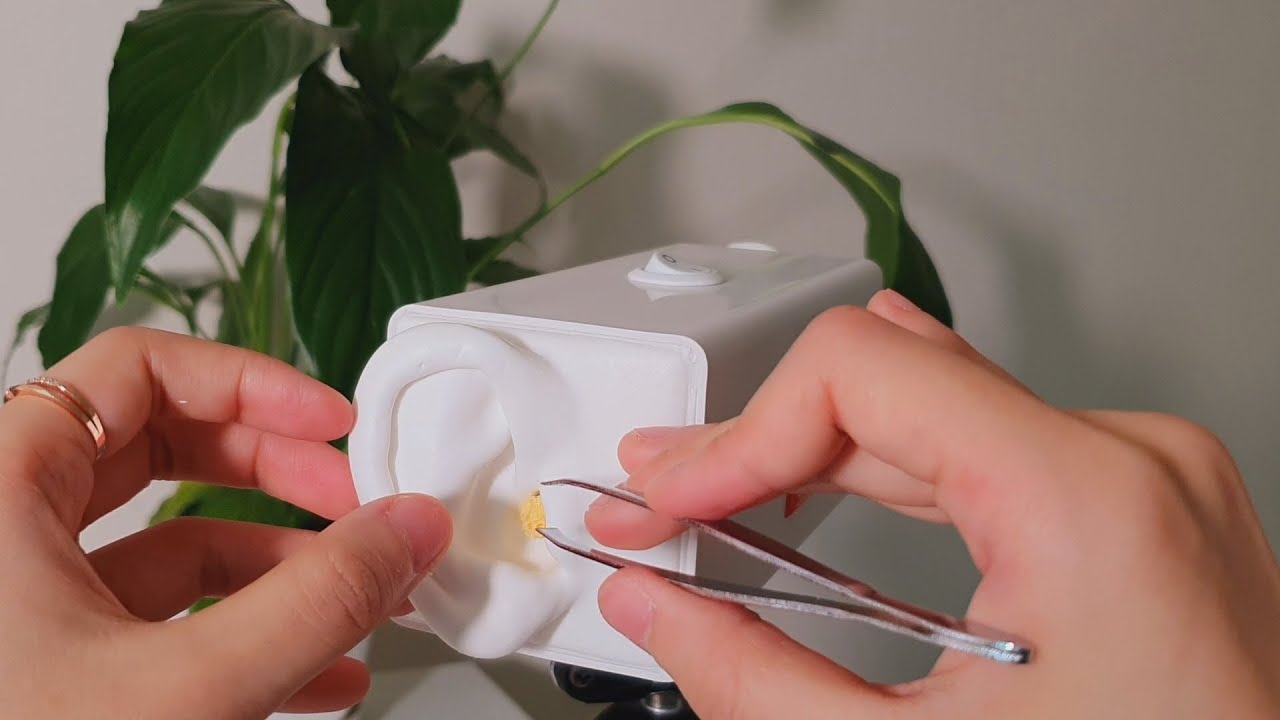 핀셋으로 늘러붙은 10년 묵은 귀지 뜯어내기 & 고막 마사지 |  Tweezers Earwax Cleaning & Eardrum Massage