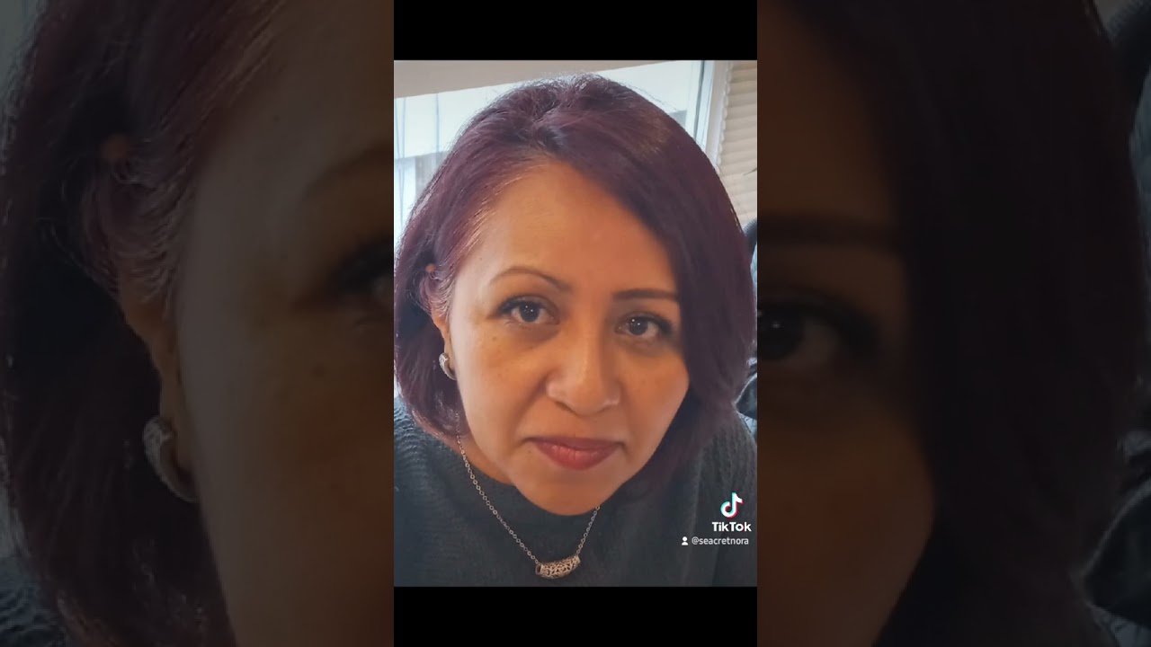 M4 Mascarilla Magnética en 5 minutos se suavizó rictus 