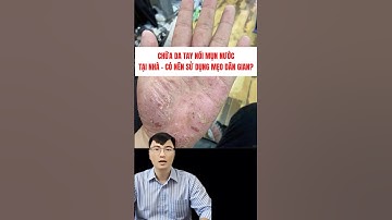 Chữa Da Tay Nổi Mụn Nước Tại Nhà – Có Nên Sử Dụng Mẹo Dân Gian?