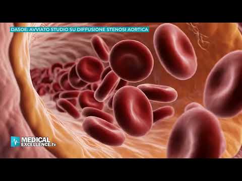 DASOE: avviato studio su diffusione stenosi aortica