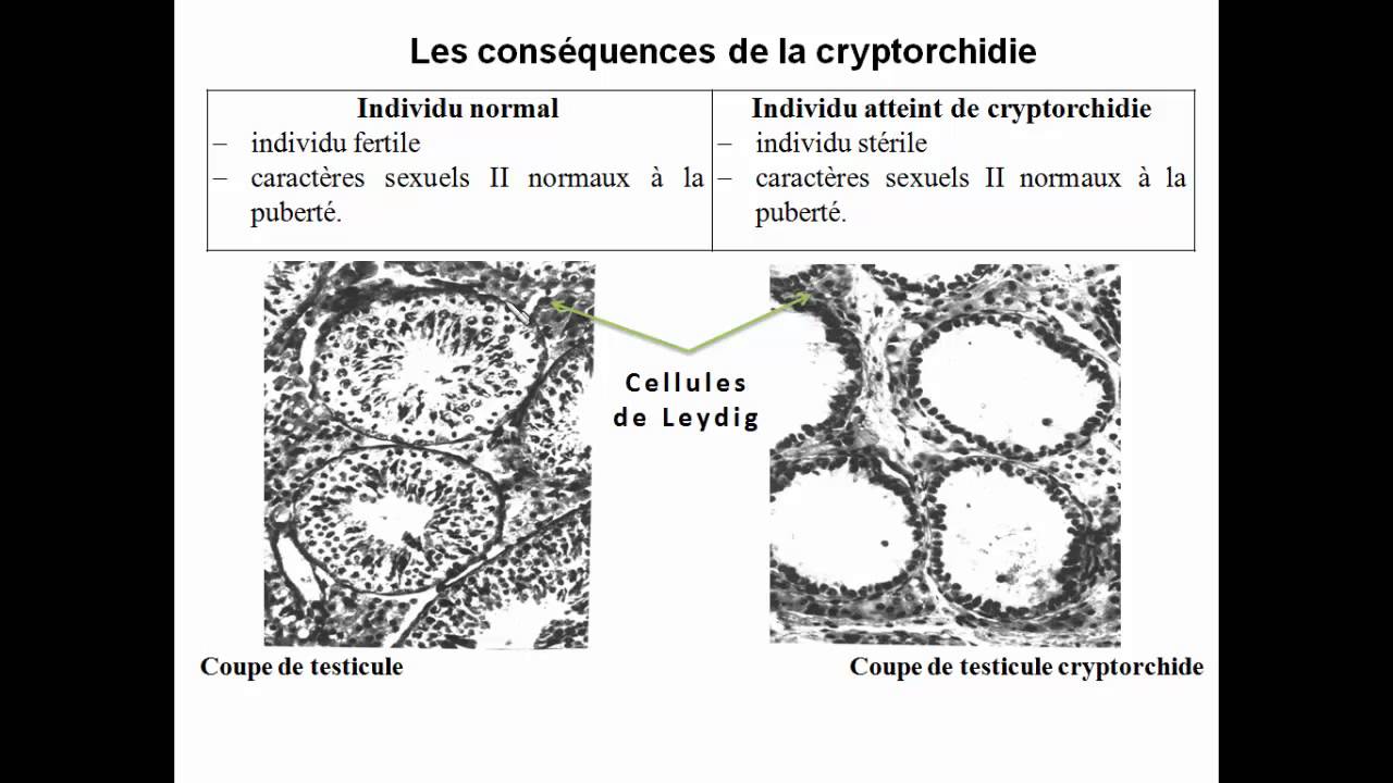 06_les cellules de leydig secrétrices de testostérone - YouTube