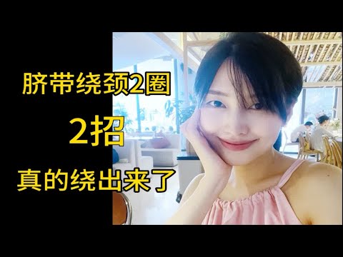 脐带绕颈怎么办？ 2招绕出来～～^_^