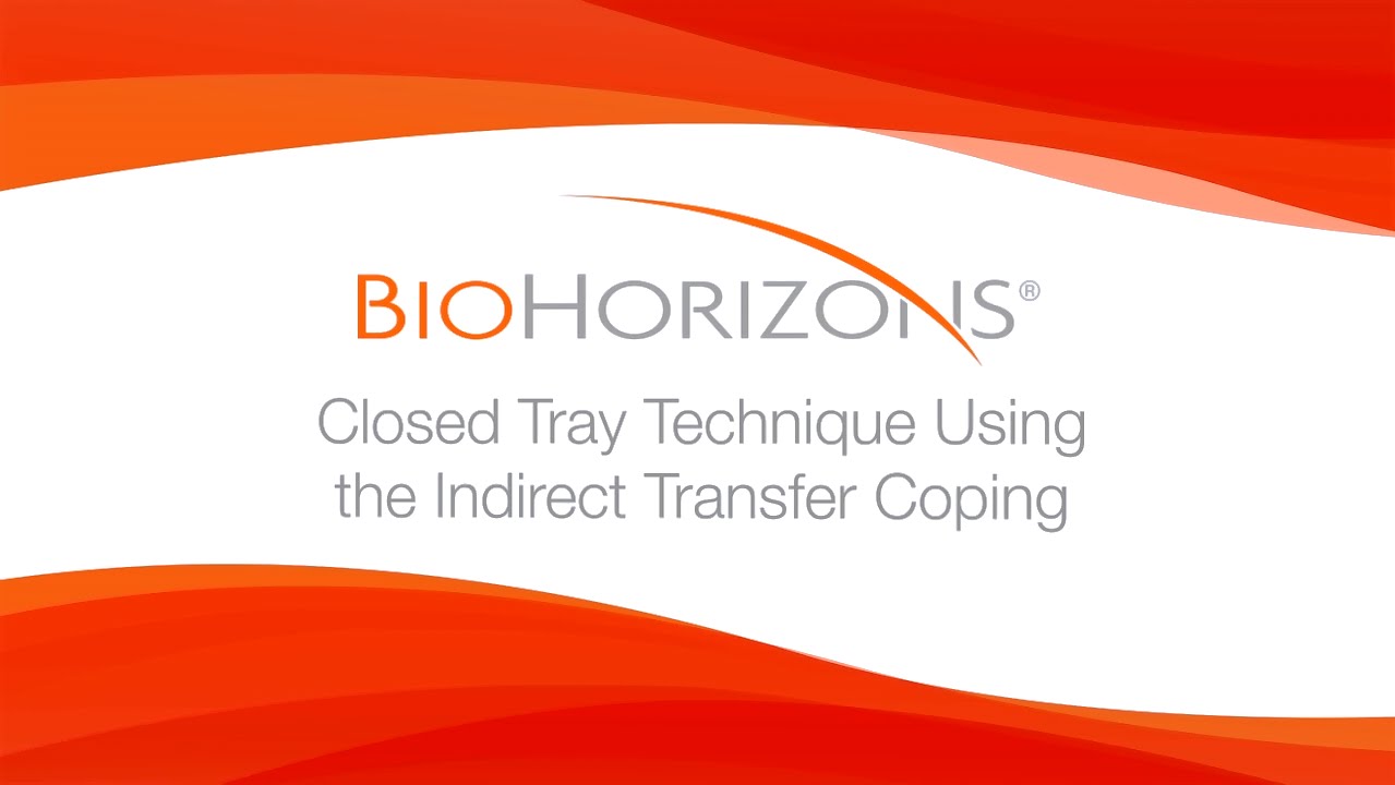 Closed Tray Technique Using the Indirect Transfer Coping