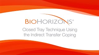 Closed Tray Technique Using the Indirect Transfer Coping