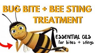 Home Remedies to Relieve Bug Bites & Bee Sting Pain FAST with Natural Essential Oils