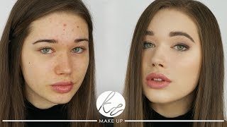 Rozświetlający makijaż dzienny dla skóry trądzikowej