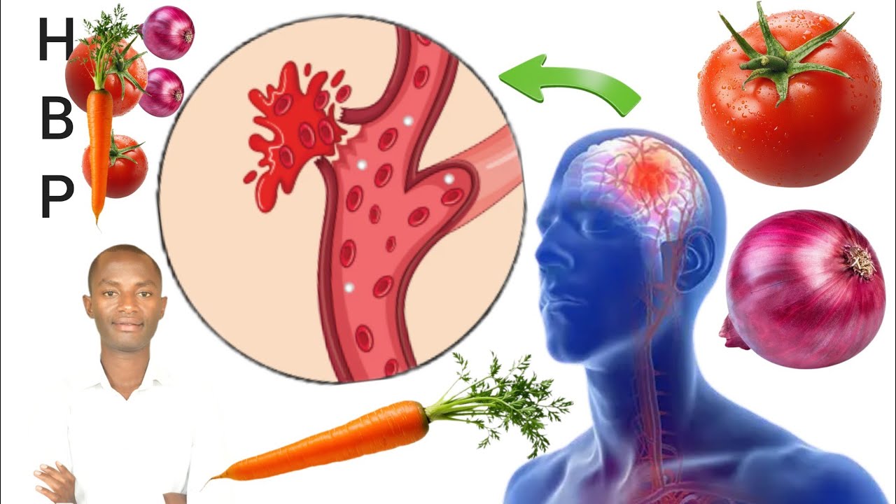 Menya izi nama. Niba urwaye umuvuduko cg ushaka kuwirinda(hypertension).