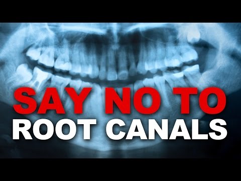 say-no-to-root-canals---damaging-to-your-health