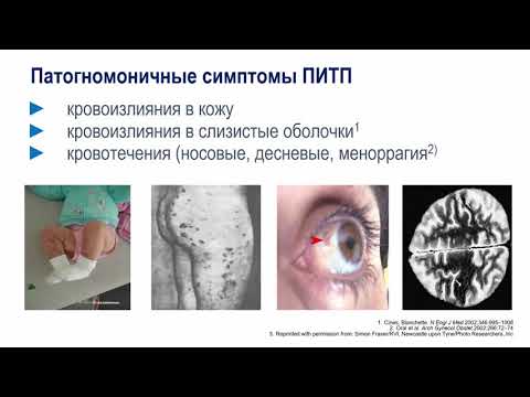 Лекция № 4 Геморрагические болезни у детей