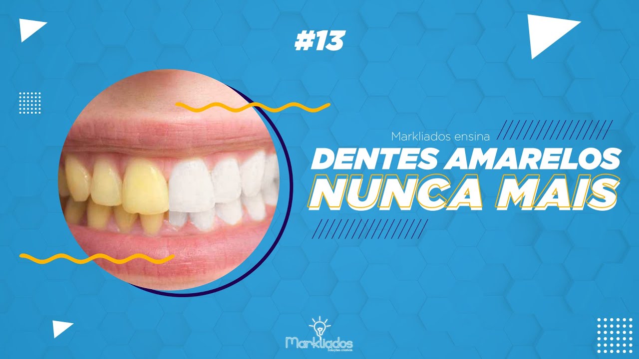 Como remover dentes amarelos (A FORMA MAIS FÁCIL) - MARKLIADOS ENSINA ...
