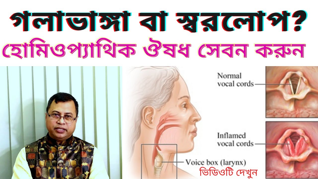 sore-throat-homeo-treatment-youtube