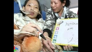 Miracle heart transplant girl Hui Yi dies at 19