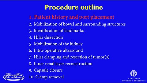 Robotic Partial Nephrectomy: Step 1 of 10 Port Placement
