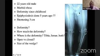 deformity analysis and preoperative planning of Osteotomies around the knee make it simple