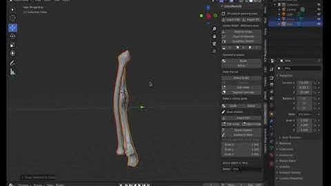 3D Slicer Segmentation and Blender for animation and surgical planning