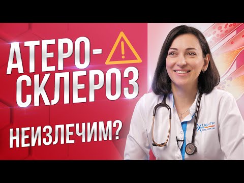 Атеросклероз - фатальная опасность. Причины, последствия, как избежать?
