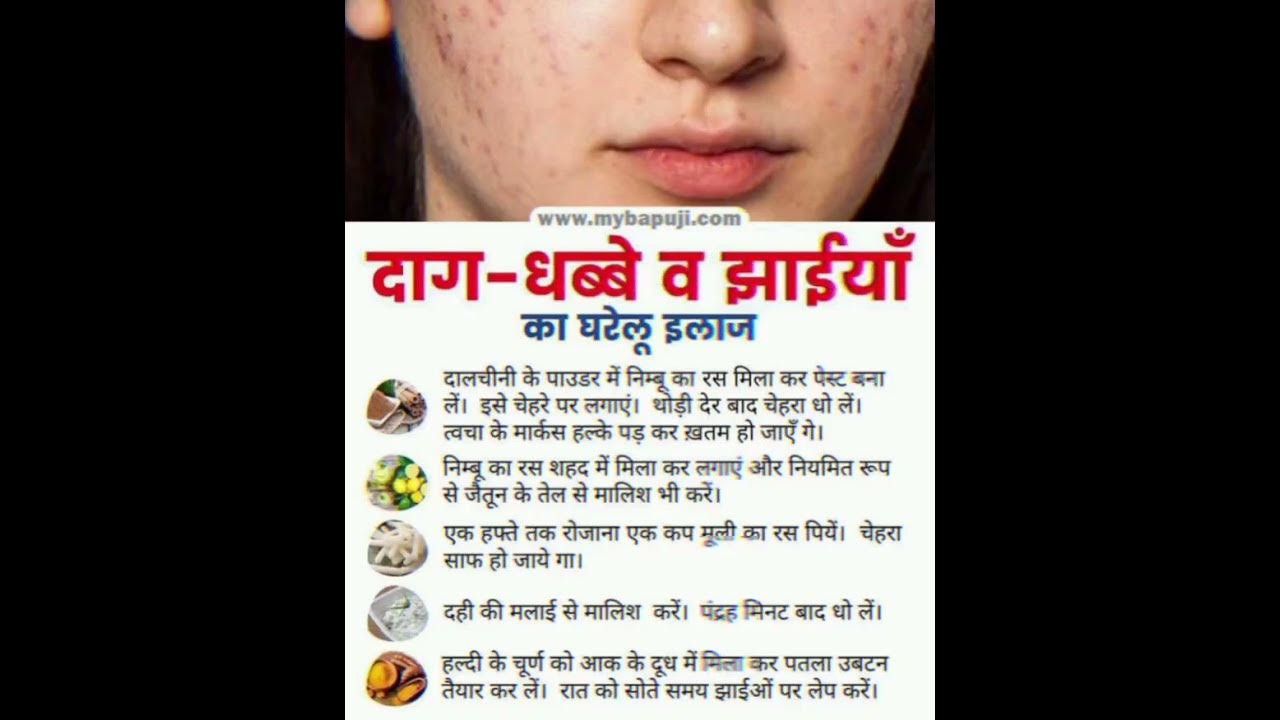 Face Cleaning Tips Daag Dhabbo Jhaiyo Ko Htane K Gharelu Upay YouTube face-cleaning-tips-daag-dhabbo-jhaiyo-ko-htane-k-gharelu-upay-youtube