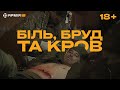 СТАБПУНКТ НА ФРОНТІ: група бійців потрапила під щільний артобстріл, медики рятують поранених